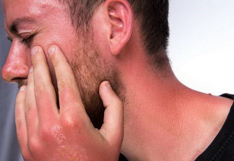 آفتابسوختگی و آسیبهای فصل گرما برای پوست