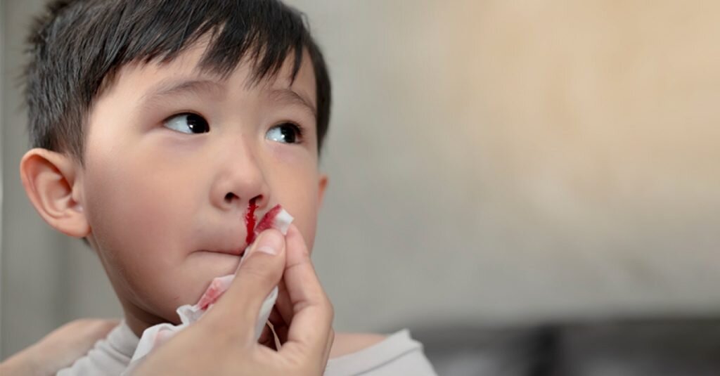 خون دماغ؛ از عوامل بروز تا علت کنترل نشدن خونریزی