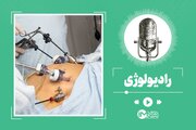 اسلیو، بادکنک و بایپس معده؛ مزایا، تفاوت‌ها و عوارض هر روش