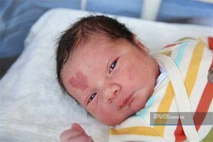 علت ماه گرفتگی روی بدن نوزاد چیست؟ | جلوگیری از ماه گرفتگی واقعی است؟