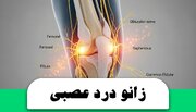 درد زانو از اعصاب است یا مشکل مفصلی؟ همه چیز درباره درد زانو