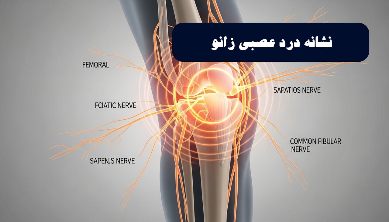 درد زانو از اعصاب