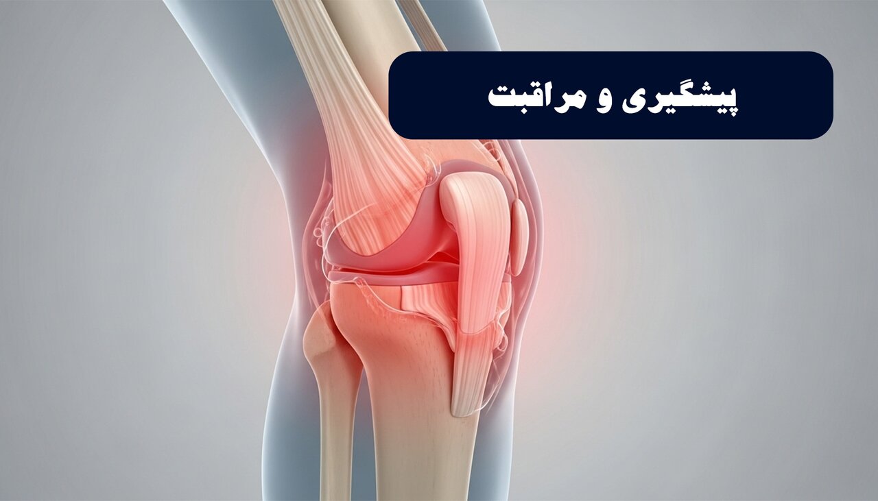 پیشگیری و مراقبت از درد زانو