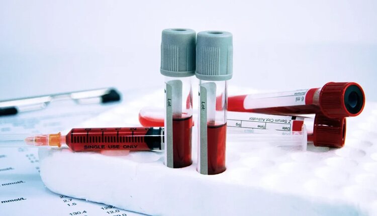 آزمایش در منزل