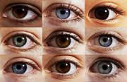 Trend of Eye Color Change Sparks Concern in Iran