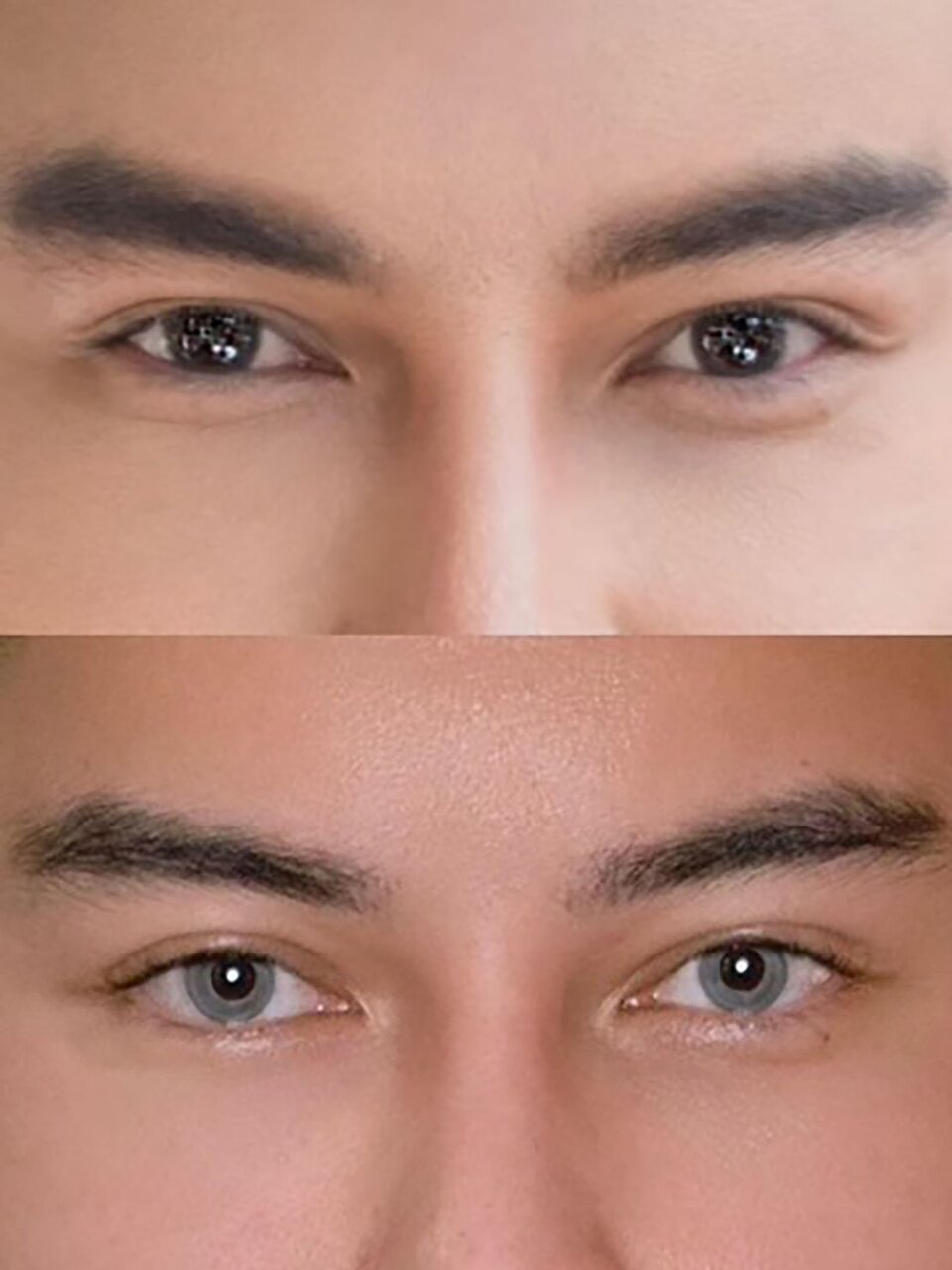 Dr. Malekahmadi Warns Against Eye Color Surgery Amid Rising Cosmetic Trend in Iran