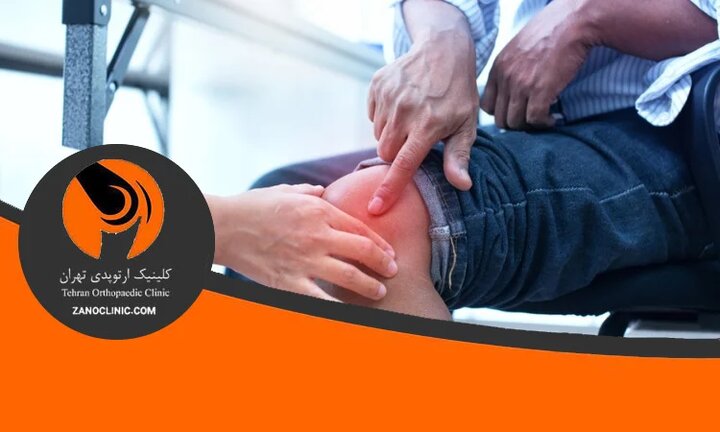 چه زمانی به تعویض مفصل زانو نیاز داریم؟ بررسی کامل نشانه‌ها و روش درمان