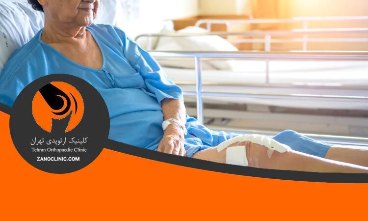 جراحی تعویض مفصل زانو