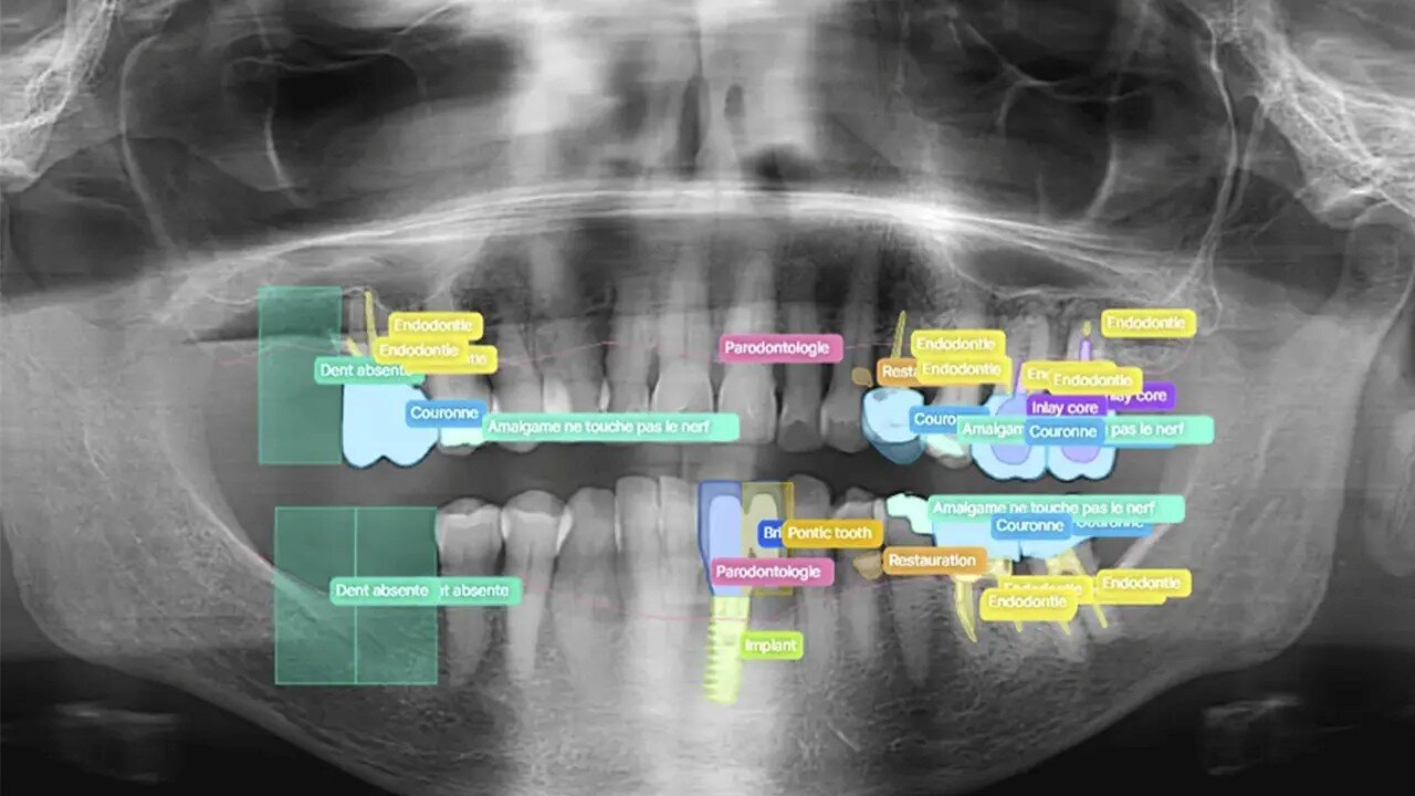 باورنکردنی: قدرت هوش مصنوعی در شخصی سازی درمان های دندانپزشکی