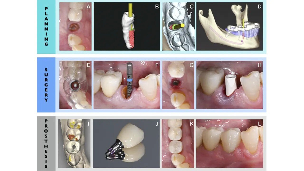 باورنکردنی: قدرت هوش مصنوعی در شخصی سازی درمان های دندانپزشکی