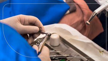 ایا افرادی که تحلیل لثه دارند میتواند ایمپلنت دیجیتال انجام دهند؟