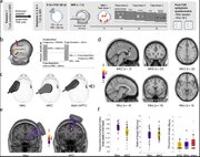 تحریک اولتراسونیک مغز