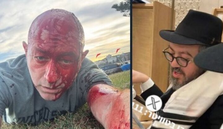 کشته شدن خاخام اسرائیلی در «حنوکای خونین» و زخمی شدن رئیس شورای یهودیان استرالیا-اسرائیل