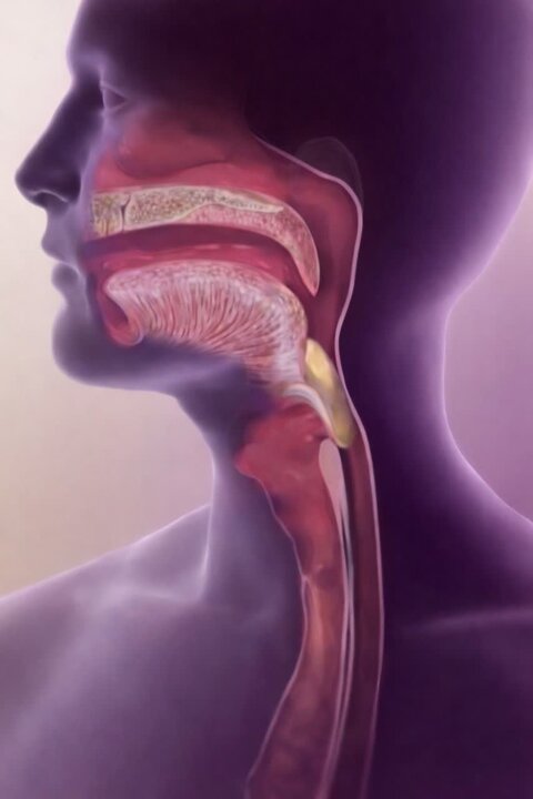 راهکار درمان اختلال بلع چیست؟