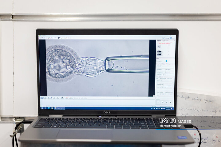 مانیتورینگ عملیات نمونه‌گیری از جنین‌های تشکیل شده به منظور بررسی وضعیت سلامت جنین و جنسیت