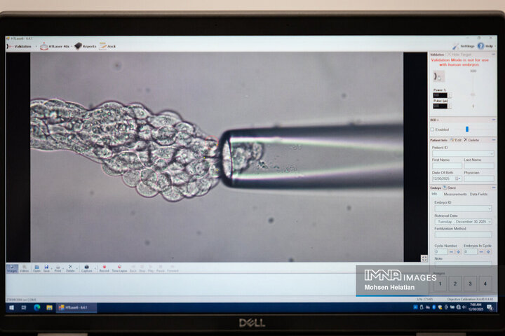 مانیتورینگ عملیات نمونه‌گیری از جنین‌های تشکیل شده به منظور بررسی وضعیت سلامت جنین و جنسیت