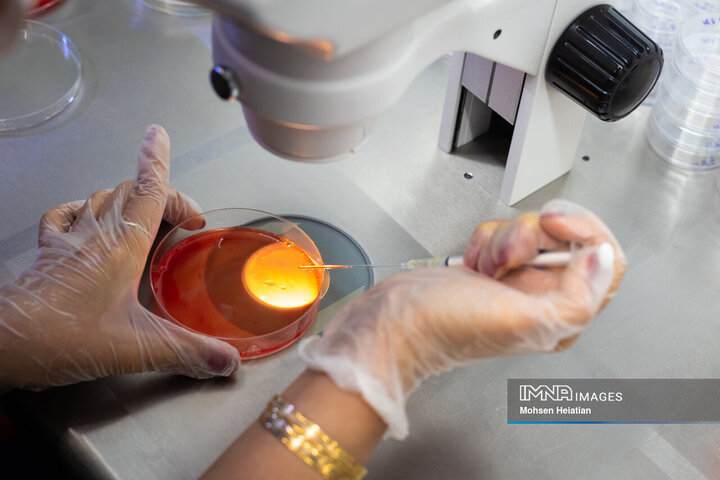 عملیات بازیابی تخمک