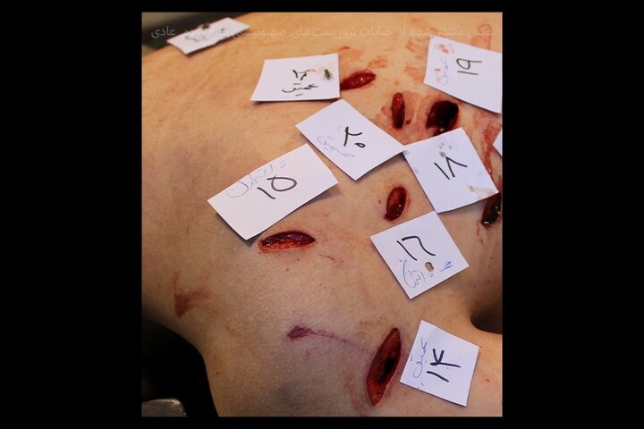 تروریست‌ها هیچ رحمی به مردم عادی نکردند/ بدن‌هایی که با قمه و چاقوهای بلند سوراخ‌ شدند