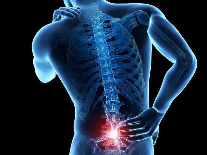 چگونه با ورزشهای خانگی درد سیاتیک را درمان کنیم؟