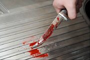 قتل دانشجوی دندانپزشکی در قزوین