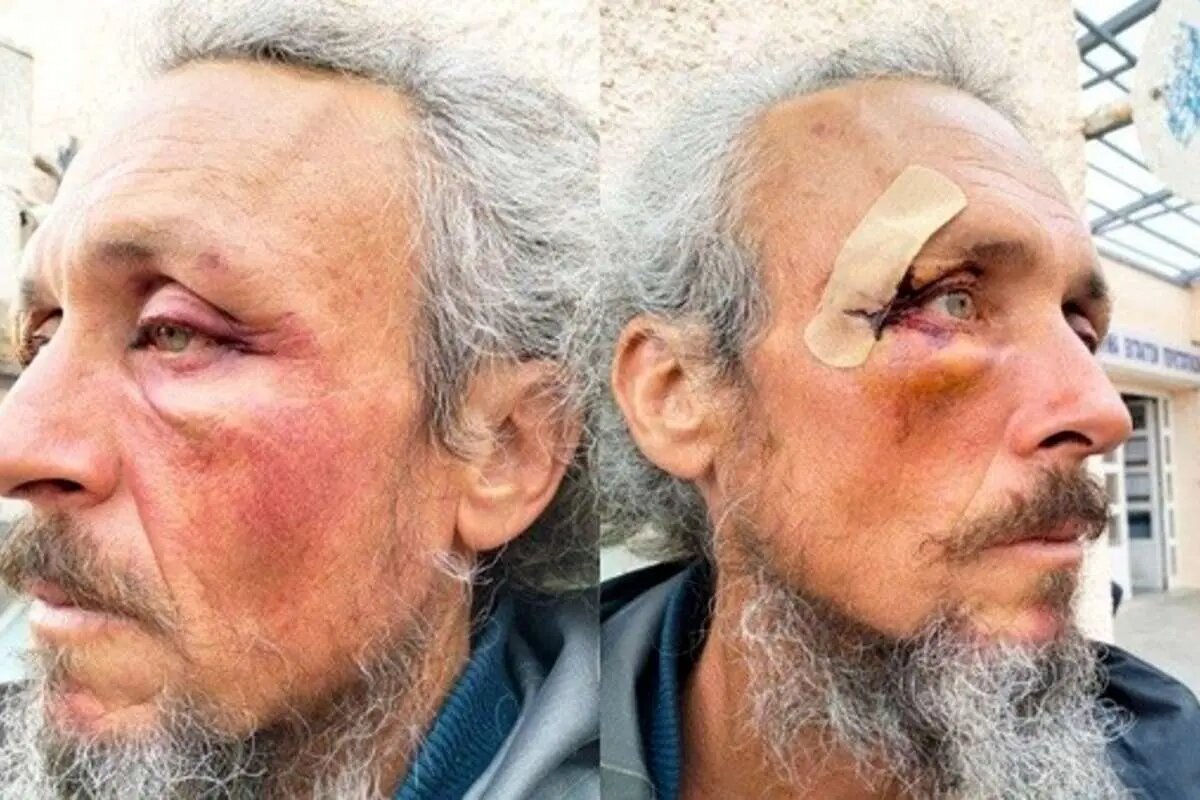 ماجرای حمله اسرائیل به ناوگان صمود ۲ / شکنجه فعالان حقوق بشر در زندان‌های شناور