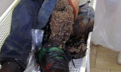 کراک ماده ای فوق العاده اعتیادآور و با عوارضی بسیار خطرناک است