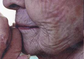 پیشگیری از چین و چروک پیری اما نه از طریق کرم‌های تبلیغاتی!