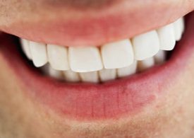 سفید کردن دندان‌ها از راه طبیعی؛ بی‌هیچ دردسری، بی‌هیچ ضرری