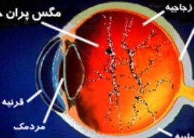 مسن‌ترها مگس‌پران چشم را جدی بگیرند