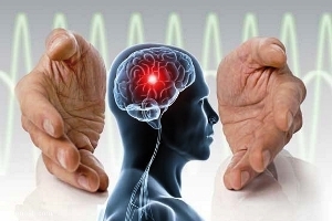 در هر ۶ ثانیه یک نفر در دنیا بر اثر سکته مغزی می‌میرد/ سکته مغزی سومین عامل مرگ و میر در جهان