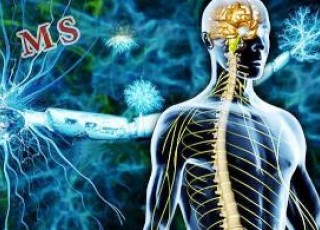 مبتلایان به ام‌اس مانعی برای ازدواج و بچه‌دار شدن ندارند