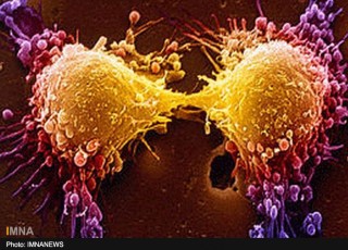 همه آنچه از سرطان پروستات باید بدانیم