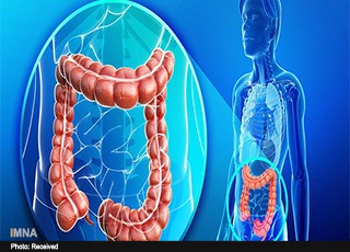 درمان کولیت عصبی از دیدگاه طب سنتی/ استرس؛ عامل مهم ایجاد ورم روده